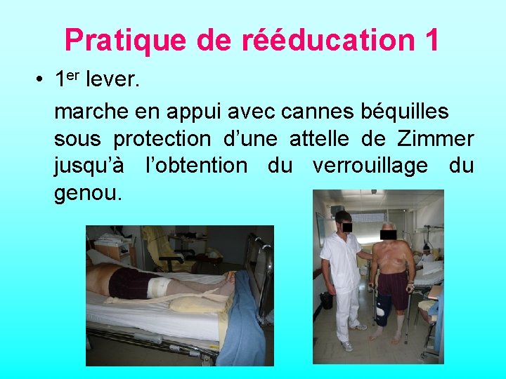 Pratique de rééducation 1 • 1 er lever. marche en appui avec cannes béquilles