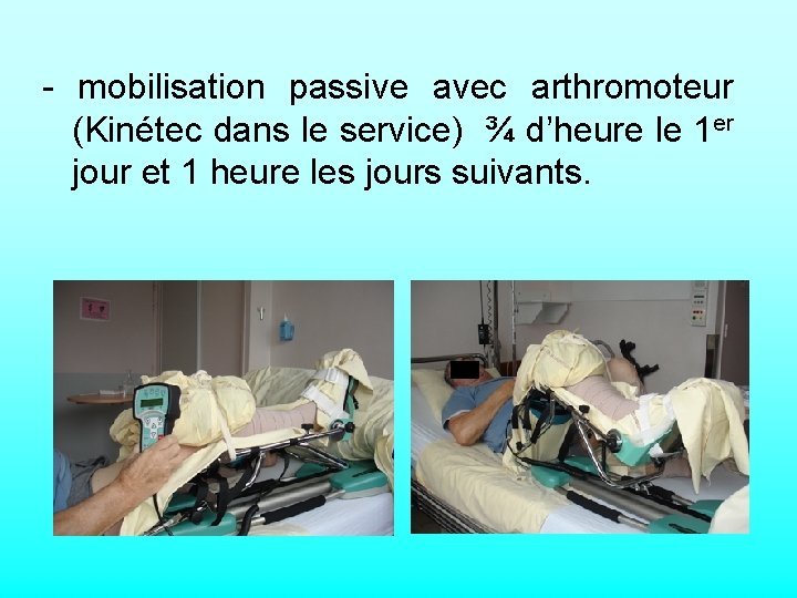 - mobilisation passive avec arthromoteur (Kinétec dans le service) ¾ d’heure le 1 er