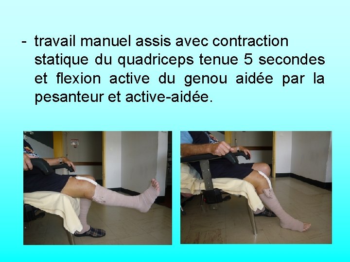 - travail manuel assis avec contraction statique du quadriceps tenue 5 secondes et flexion
