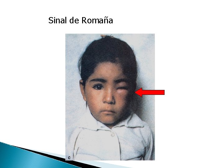 Sinal de Romaña 