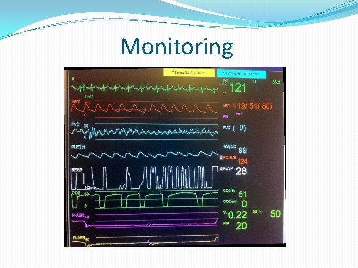 Monitoring 