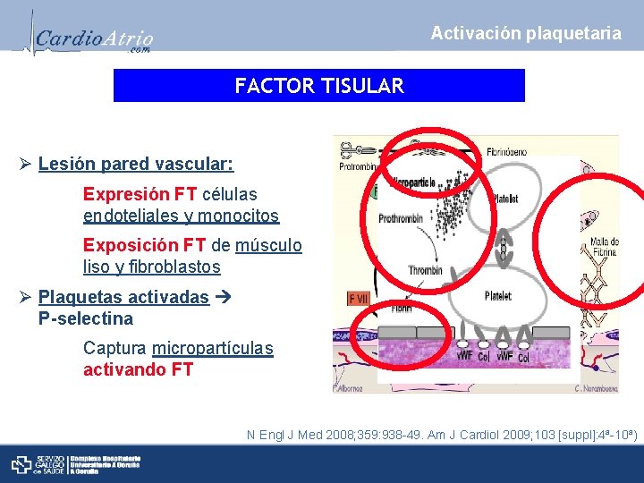 Activación plaquetaria FACTOR TISULAR Ø Lesión pared vascular: Expresión FT células endoteliales y monocitos