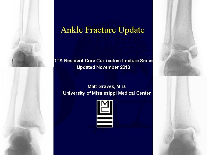 Ankle Fracture Update OTA Resident Core Curriculum Lecture Series Updated November 2010 Matt Graves,