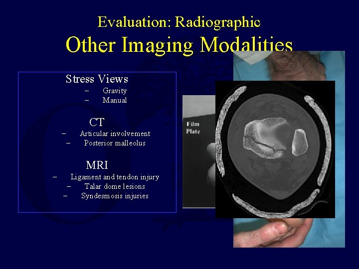 Evaluation: Radiographic Other Imaging Modalities Stress Views – – Gravity Manual CT – – Evaluation: Radiographic Other Imaging Modalities Stress Views – – Gravity Manual CT – –