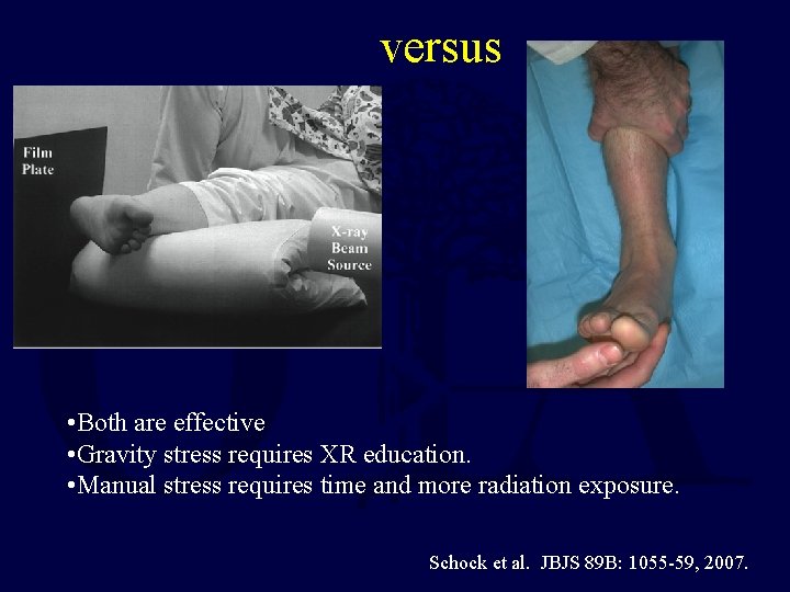 versus • Both are effective • Gravity stress requires XR education. • Manual stress