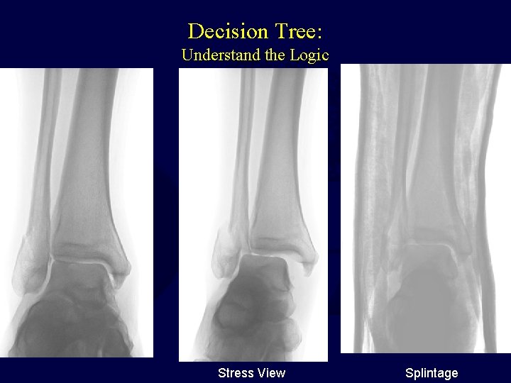 Decision Tree: Understand the Logic Stress View Splintage 