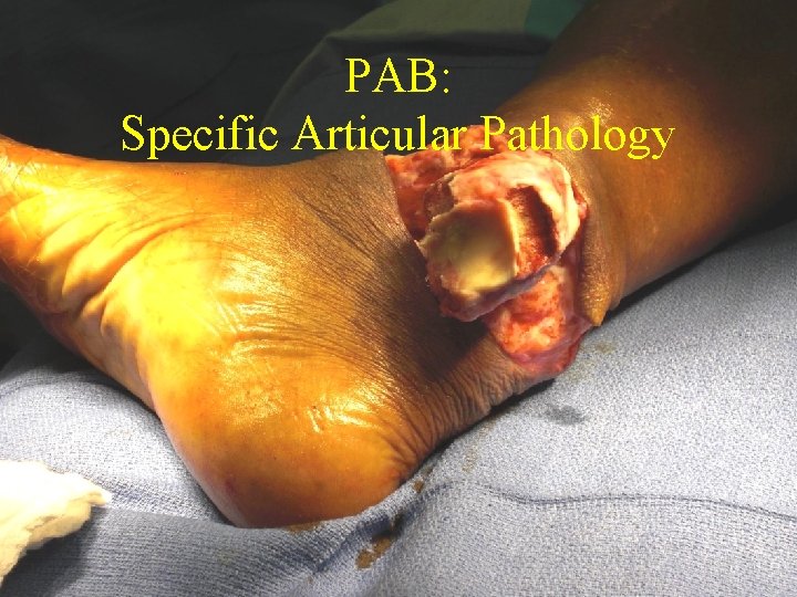 PAB: Specific Articular Pathology PAB: Specific Articular Pathology