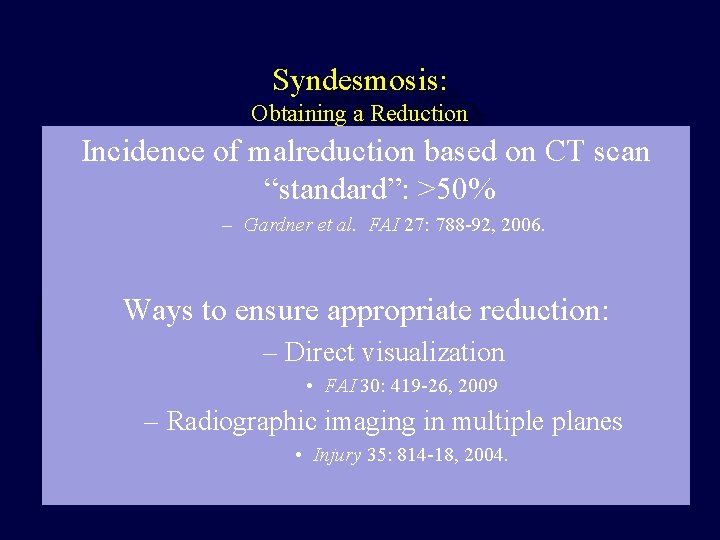 Syndesmosis: Obtaining a Reduction Incidence of malreduction based on CT scan “standard”: >50% –