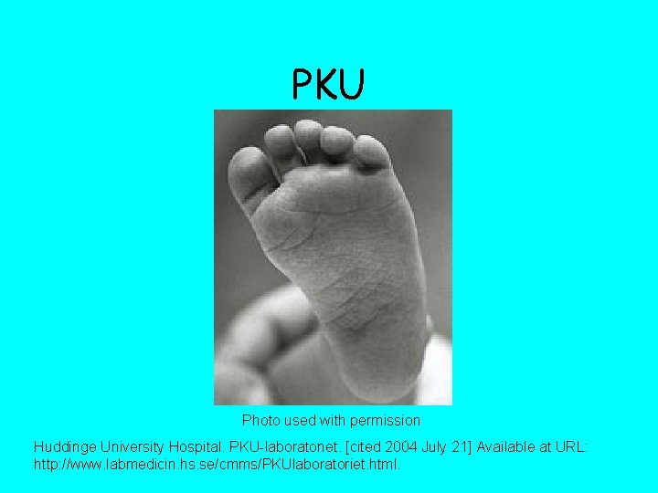 PKU Photo used with permission Huddinge University Hospital. PKU-laboratonet. [cited 2004 July 21] Available