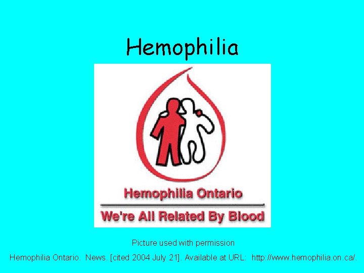 Hemophilia Picture used with permission Hemophilia Ontario. News. [cited 2004 July 21]. Available at