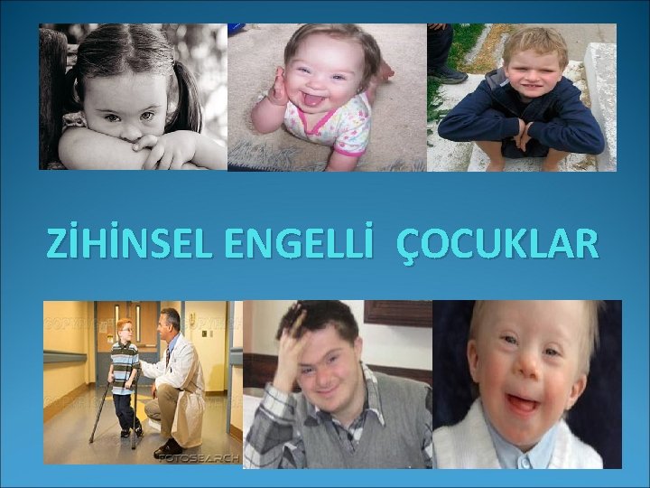 ZİHİNSEL ENGELLİ ÇOCUKLAR 