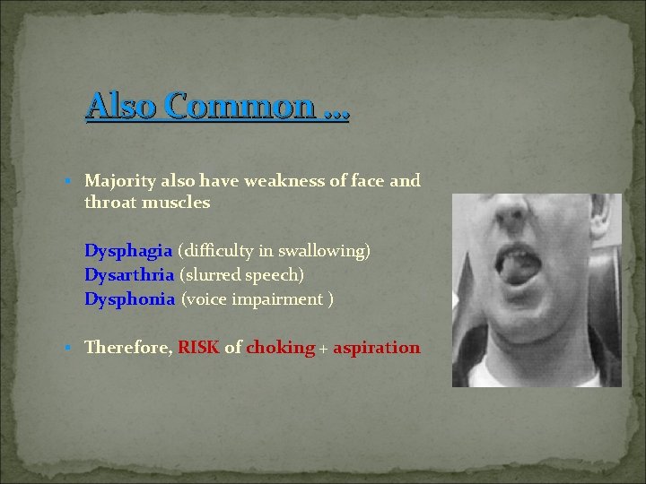 Also Common … § Majority also have weakness of face and throat muscles Dysphagia