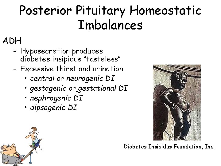 Posterior Pituitary Homeostatic Imbalances ADH – Hyposecretion produces diabetes insipidus “tasteless” – Excessive thirst