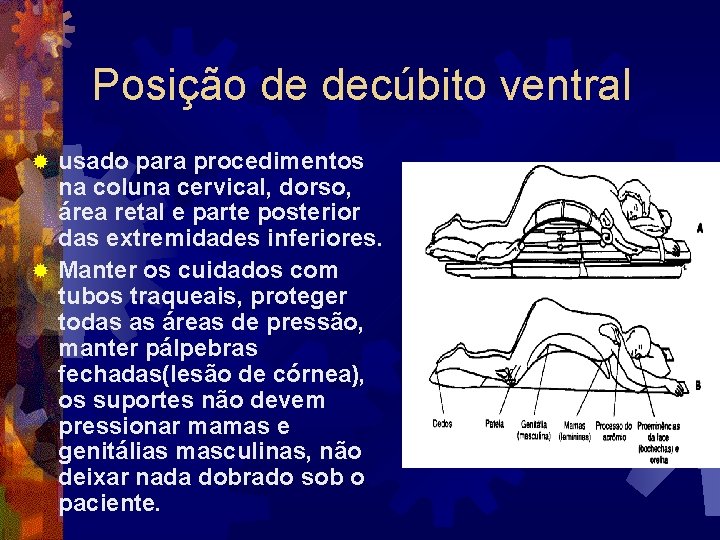 Posição de decúbito ventral usado para procedimentos na coluna cervical, dorso, área retal e