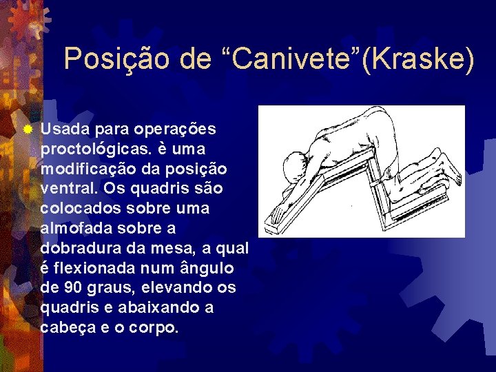 Posição de “Canivete”(Kraske) ® Usada para operações proctológicas. è uma modificação da posição ventral.