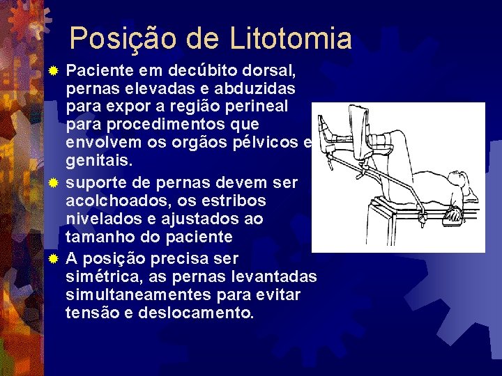 Posição de Litotomia Paciente em decúbito dorsal, pernas elevadas e abduzidas para expor a