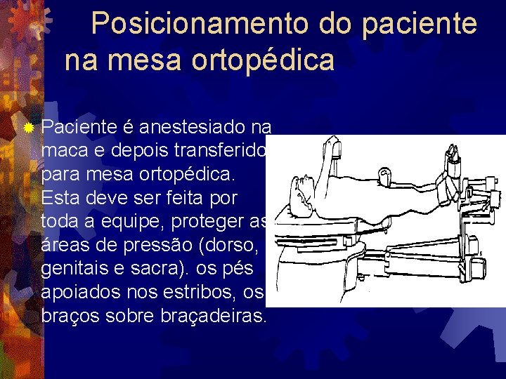 Posicionamento do paciente na mesa ortopédica ® Paciente é anestesiado na maca e depois