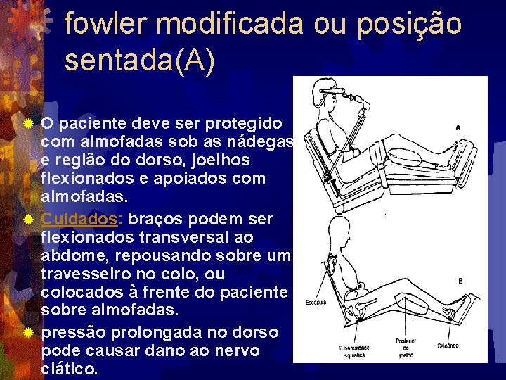 fowler modificada ou posição sentada(A) O paciente deve ser protegido com almofadas sob as