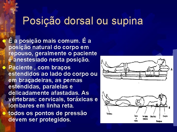 Posição dorsal ou supina É a posição mais comum. É a posição natural do
