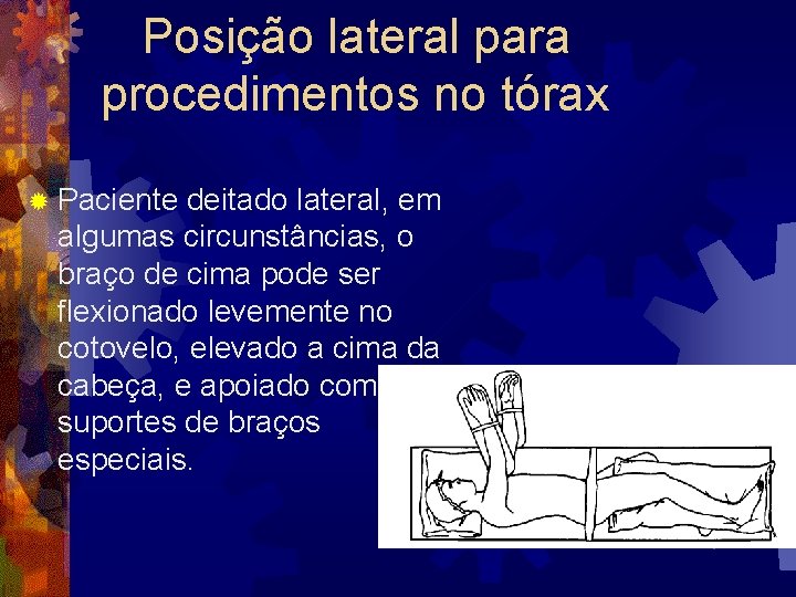 Posição lateral para procedimentos no tórax ® Paciente deitado lateral, em algumas circunstâncias, o