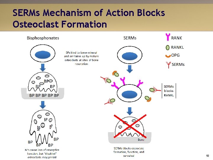 SERMs Mechanism of Action Blocks Osteoclast Formation 18 