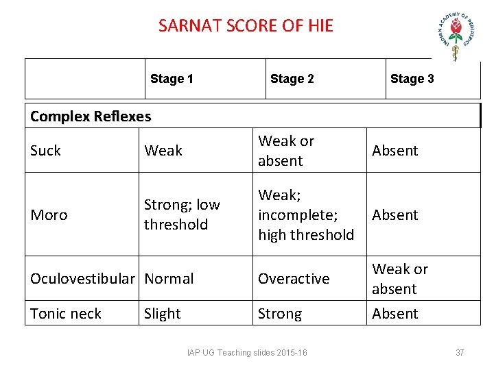 SARNAT SCORE OF HIE Stage 1 Stage 2 Stage 3 Complex Reflexes Suck Weak SARNAT SCORE OF HIE Stage 1 Stage 2 Stage 3 Complex Reflexes Suck Weak