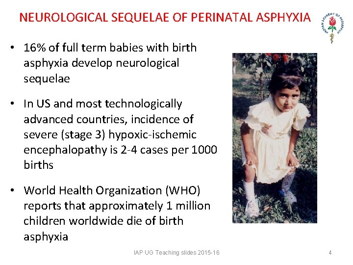NEUROLOGICAL SEQUELAE OF PERINATAL ASPHYXIA • 16% of full term babies with birth asphyxia NEUROLOGICAL SEQUELAE OF PERINATAL ASPHYXIA • 16% of full term babies with birth asphyxia