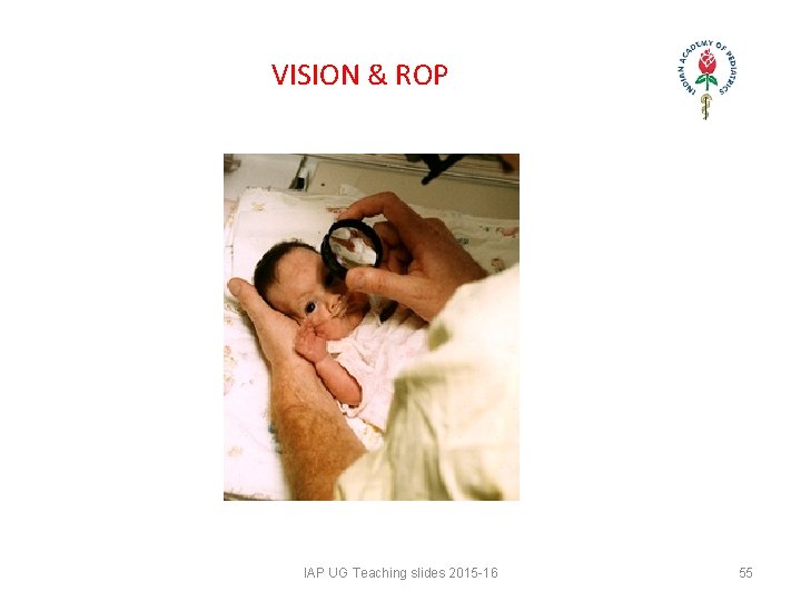 VISION & ROP IAP UG Teaching slides 2015 -16 55 VISION & ROP IAP UG Teaching slides 2015 -16 55