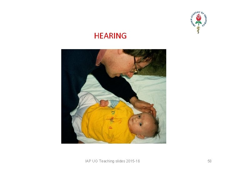 HEARING IAP UG Teaching slides 2015 -16 58 HEARING IAP UG Teaching slides 2015 -16 58