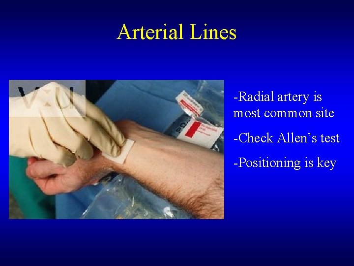 Arterial Lines -Radial artery is most common site -Check Allen’s test -Positioning is key