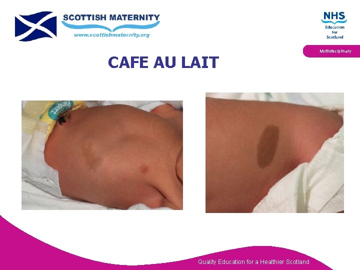 CAFE AU LAIT Quality Education for a Healthier Scotland Multidisciplinary 
