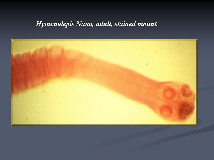 Hymenolepis Nana, adult, stained mount. 