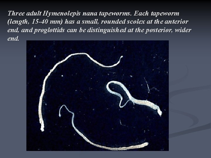 Three adult Hymenolepis nana tapeworms. Each tapeworm (length, 15 -40 mm) has a small,