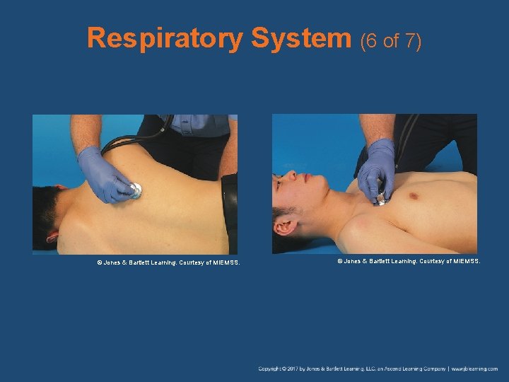 Respiratory System (6 of 7) © Jones & Bartlett Learning. Courtesy of MIEMSS. 