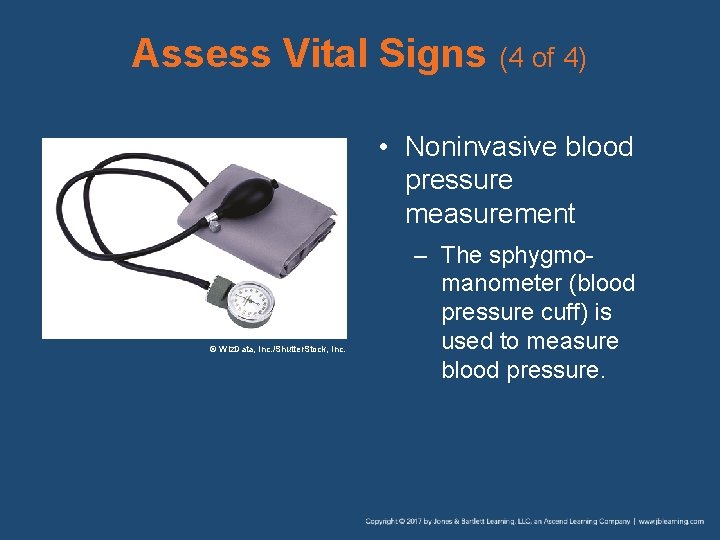 Assess Vital Signs (4 of 4) • Noninvasive blood pressure measurement © Wiz. Data,