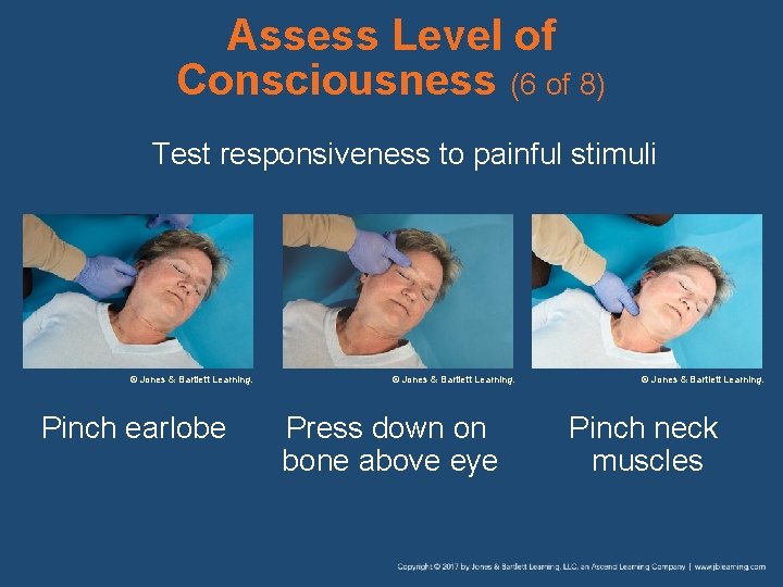 Assess Level of Consciousness (6 of 8) Test responsiveness to painful stimuli © Jones