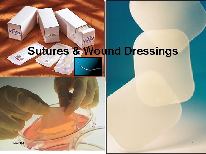 Sutures & Wound Dressings 12/5/2020 1 Sutures & Wound Dressings 12/5/2020 1