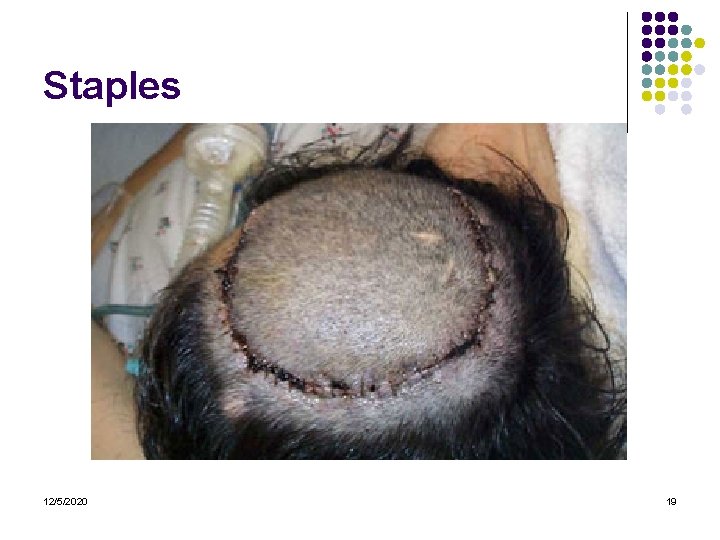 Staples 12/5/2020 19 Staples 12/5/2020 19