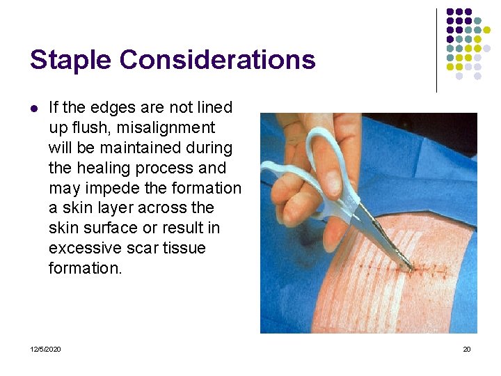 Staple Considerations l If the edges are not lined up flush, misalignment will be Staple Considerations l If the edges are not lined up flush, misalignment will be
