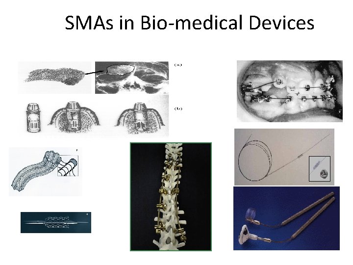 SMAs in Bio-medical Devices 