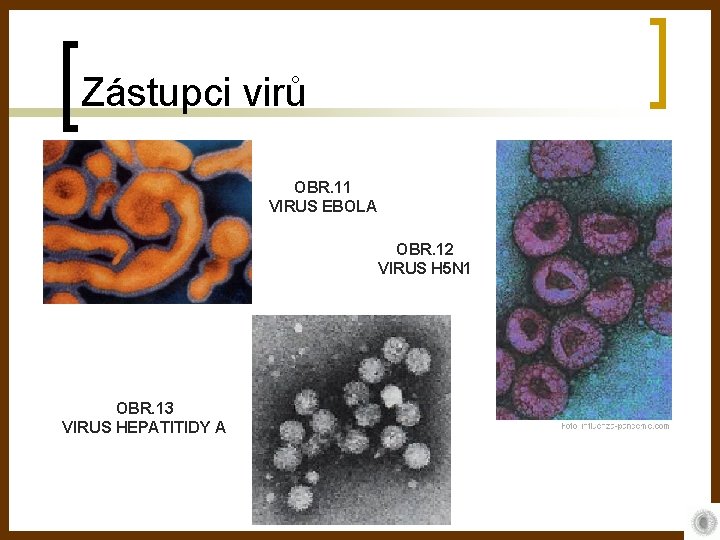 Zástupci virů OBR. 11 VIRUS EBOLA OBR. 12 VIRUS H 5 N 1 OBR.