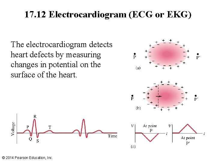 17. 12 Electrocardiogram (ECG or EKG) The electrocardiogram detects heart defects by measuring changes