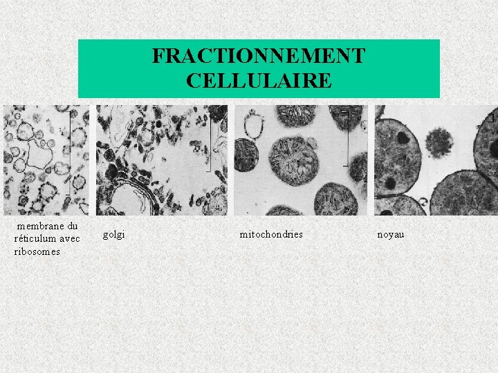 FRACTIONNEMENT CELLULAIRE membrane du réticulum avec ribosomes golgi mitochondries noyau 