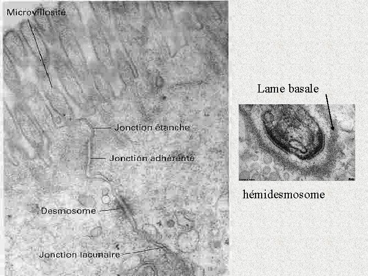 Lame basale hémidesmosome 