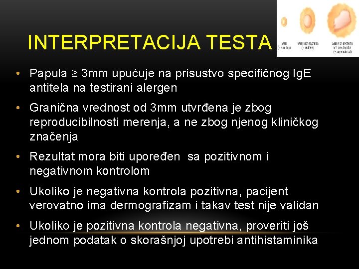 INTERPRETACIJA TESTA • Papula ≥ 3 mm upućuje na prisustvo specifičnog Ig. E antitela