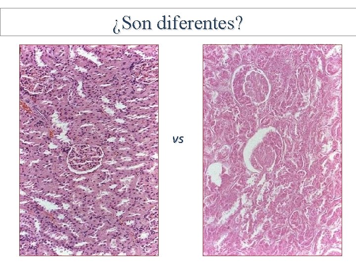 ¿Son diferentes? vs 