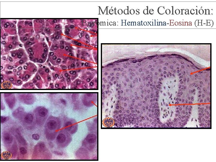 Métodos de Coloración: Bicrómica: Hematoxilina-Eosina (H-E) 