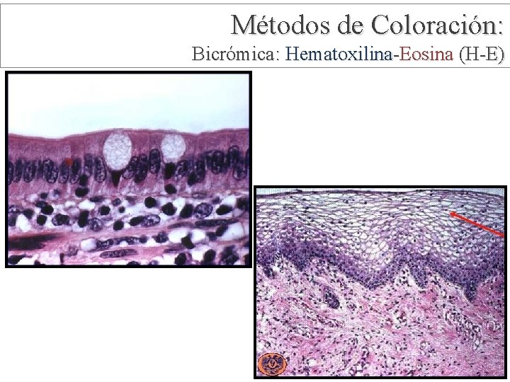 Métodos de Coloración: Bicrómica: Hematoxilina-Eosina (H-E) 