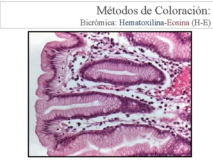 Métodos de Coloración: Bicrómica: Hematoxilina-Eosina (H-E) 