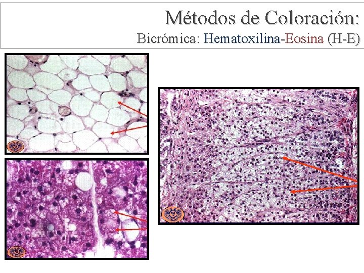 Métodos de Coloración: Bicrómica: Hematoxilina-Eosina (H-E) 